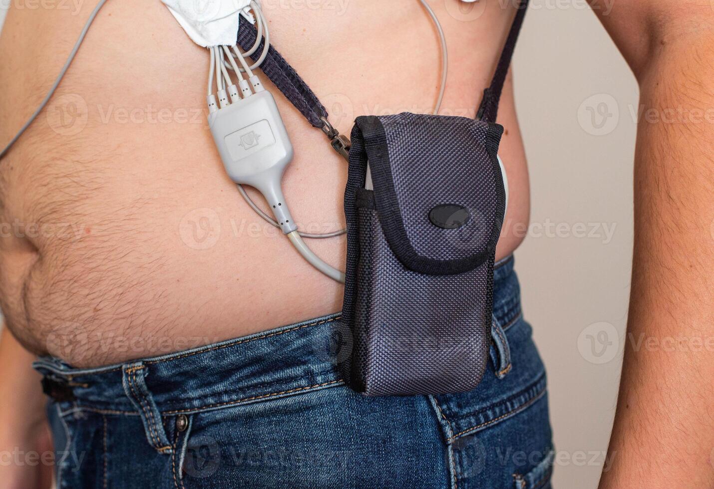 An obese man undergoes a Holter monitoring of the heart. Control of blood supply and disorders of the heart after myocardial infarction, electrocardiogram photo