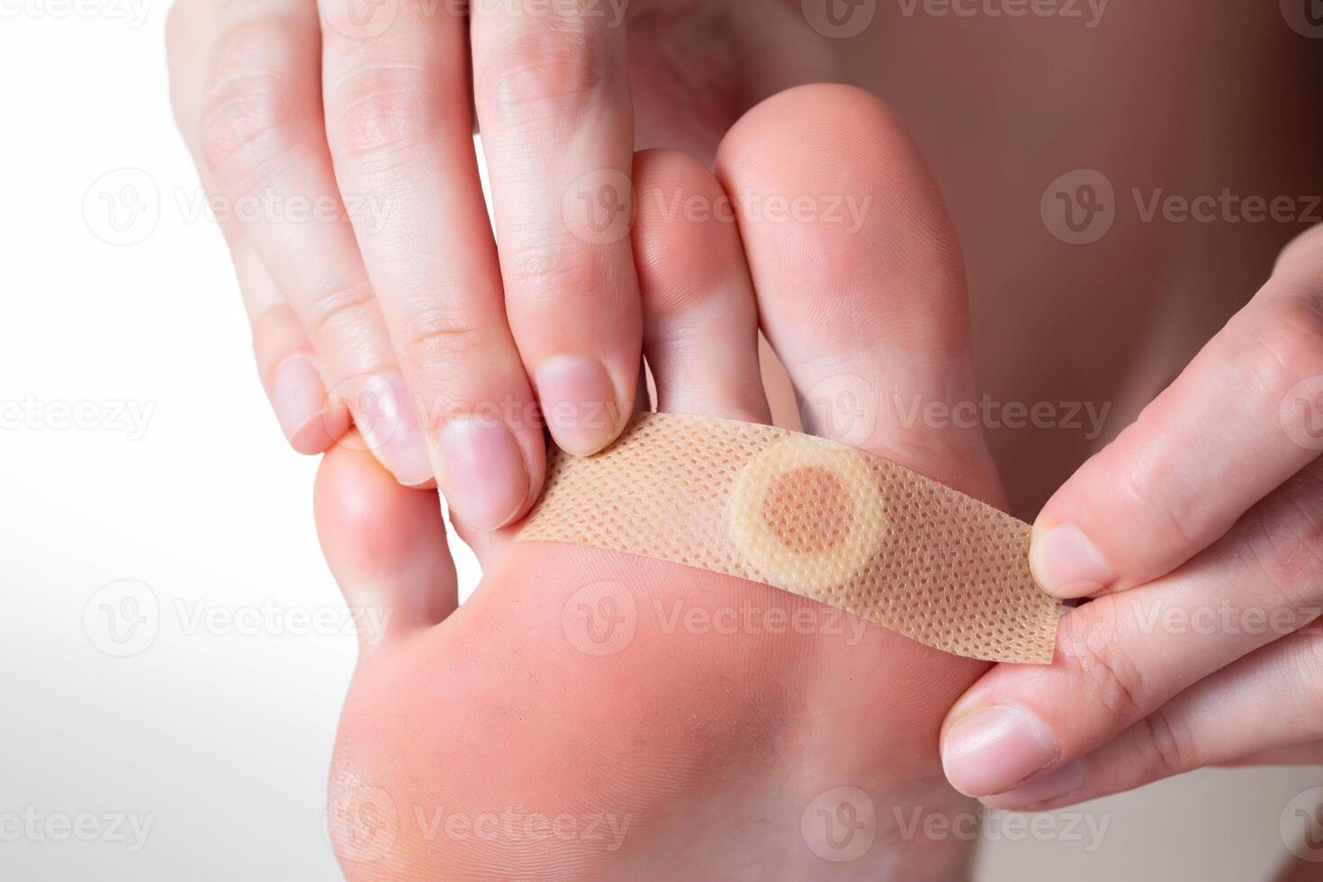 A girl sticks a medical plaster for plantar warts on her leg. Callus treatment, dermatological photo