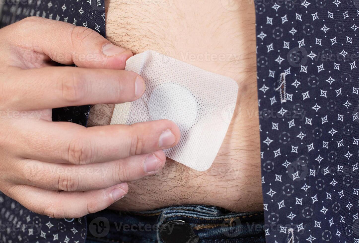 A modern medical patch for prostatitis and urinary tract infections. A man glues a urological patch on his stomach, close-up photo