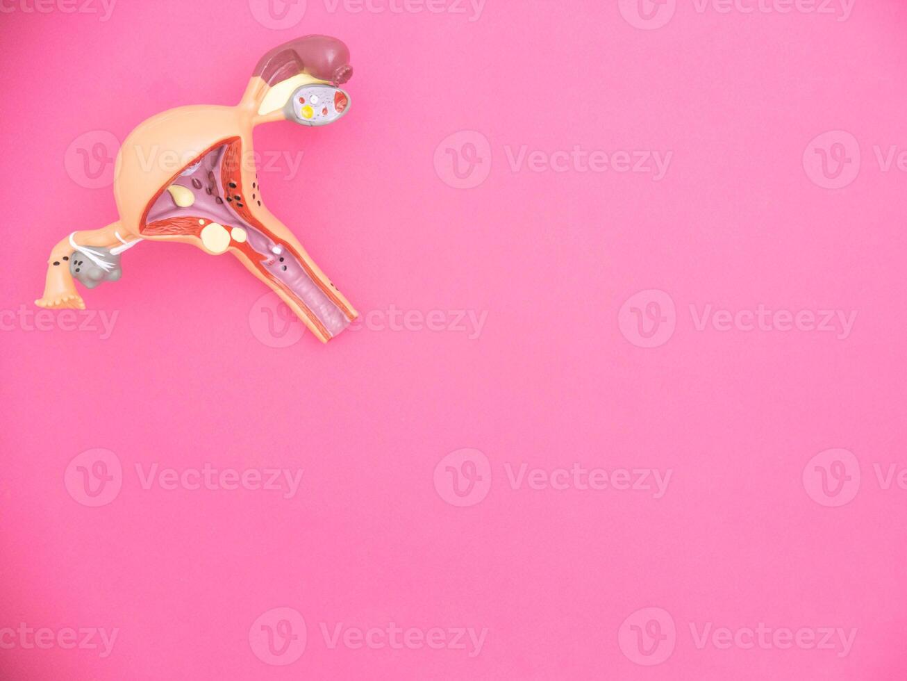 Layout of the female reproductive system on a pink background. Concept of types of medical abortion in early pregnancy, copy space for text photo