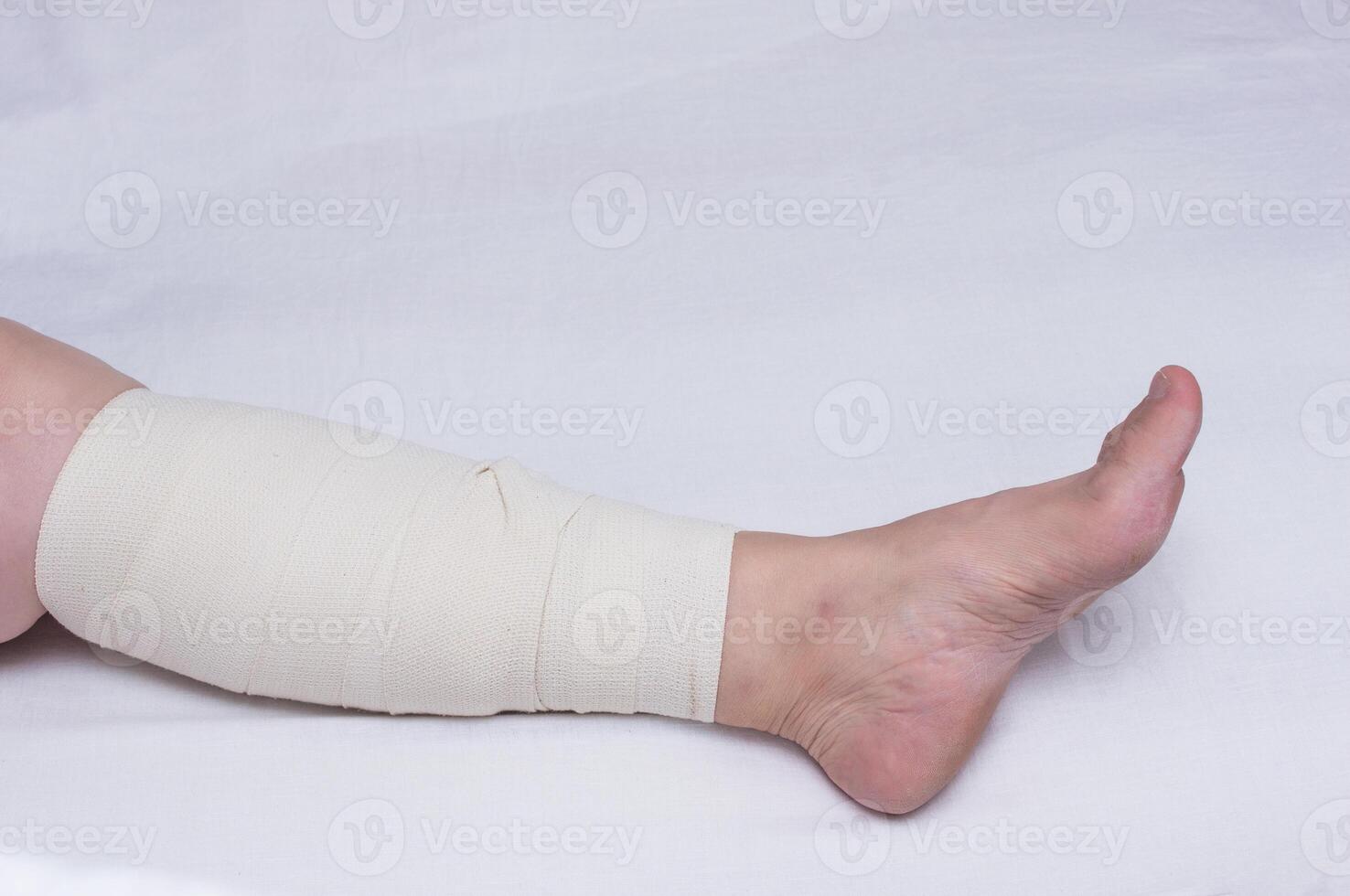 Leg of an elderly woman bandaged with an elastic bandage against varicose veins on the leg, close-up, white background, phlebeurysm, arteries, trauma photo