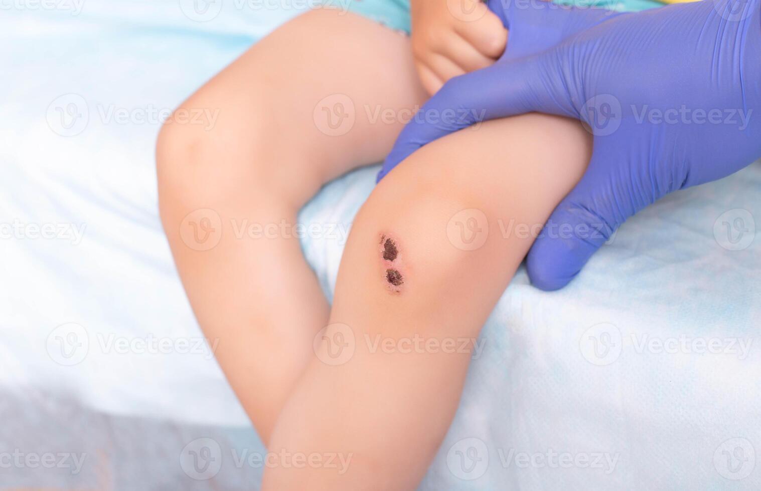 The doctor examines a bruise and a wound on the child's knee. Concept of children's health and medicine, damaged photo