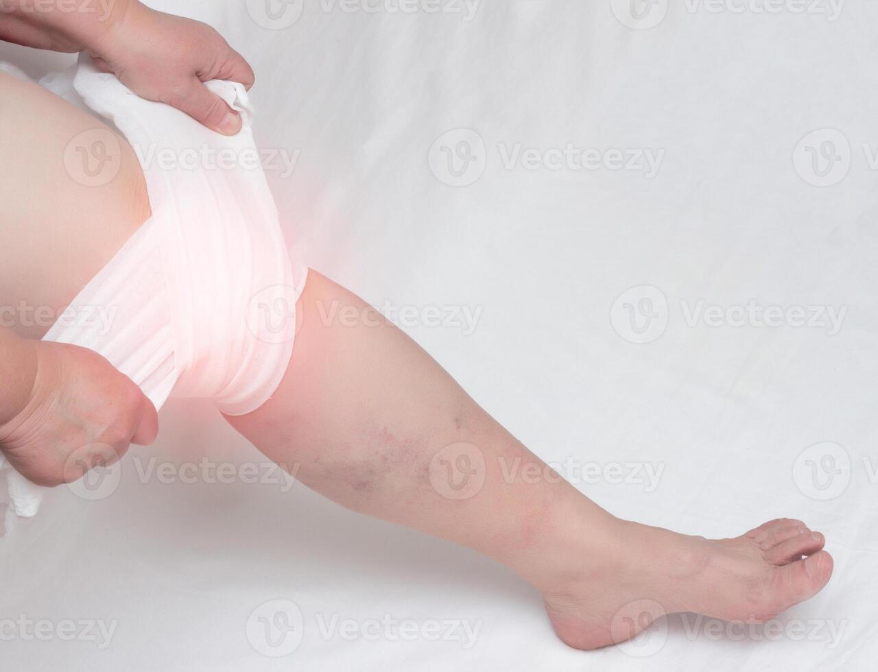 Treatment of arthritis of the knee and inflammation with a medical compress, tight bandage, close-up, copy space, synovitis photo