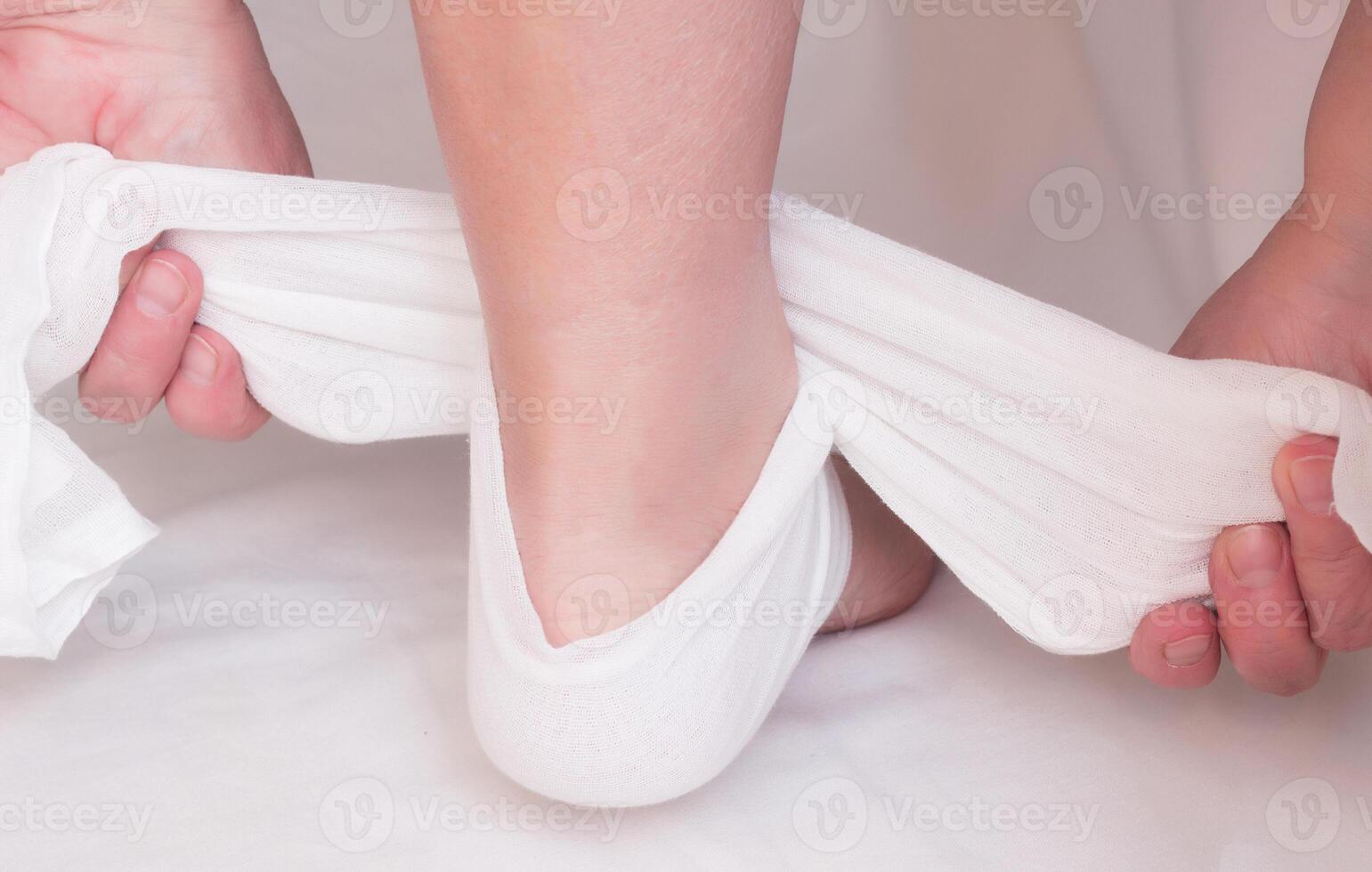 A woman sets up a compress on a sore heel in which osteophytes, heel spurs and inflammation, pain relief, alternative medicine, close-up, trauma photo