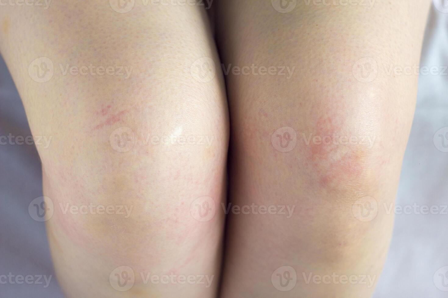 Kneeling, female legs of the knees photo