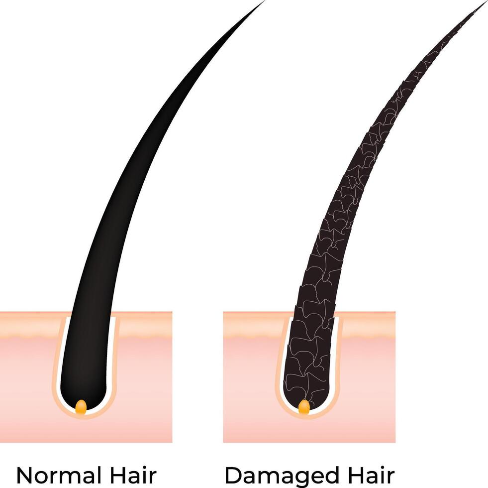 Normal Hair and Damaged Hair Science Desgin Illustration Diagram vector