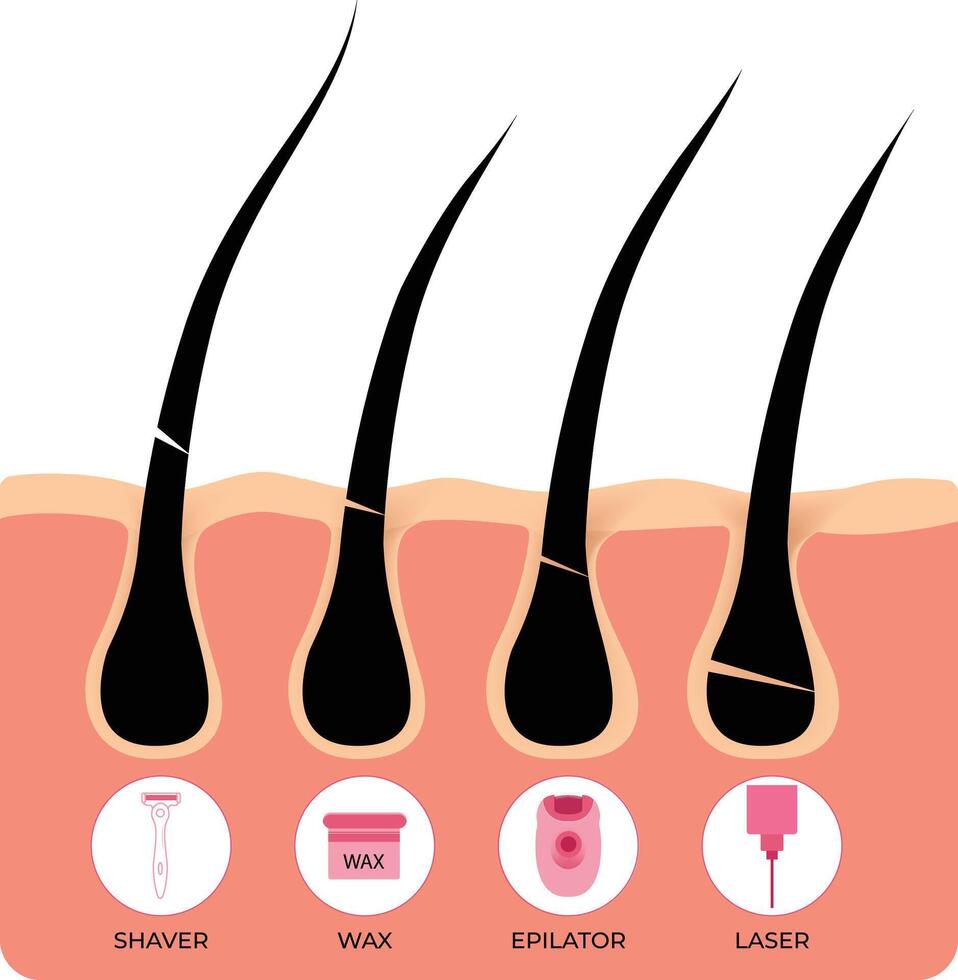 Shaver Wax Epilator Laser Design Illustration vector
