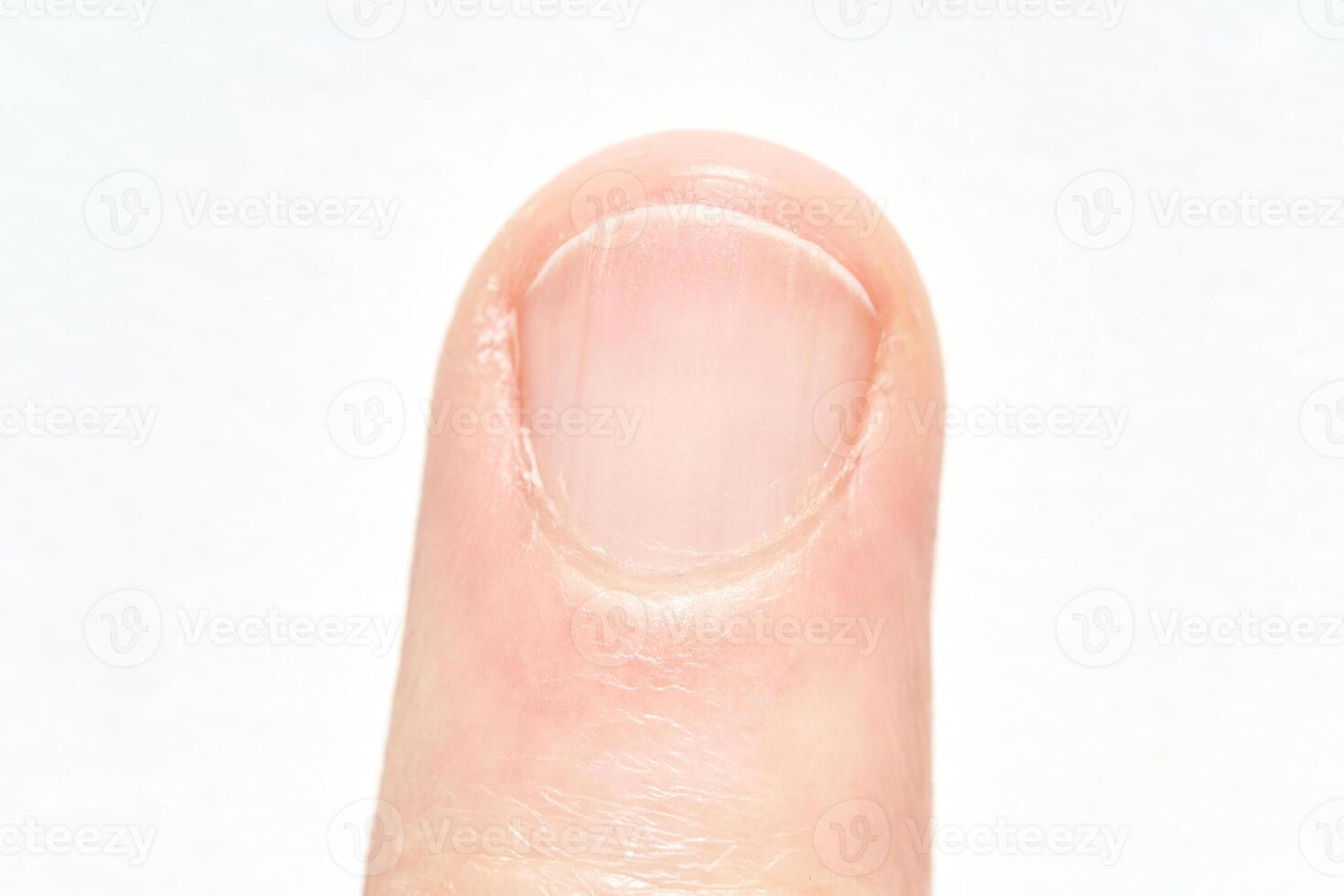 Close up view of a human fingernail on a caucasian adult finger. photo