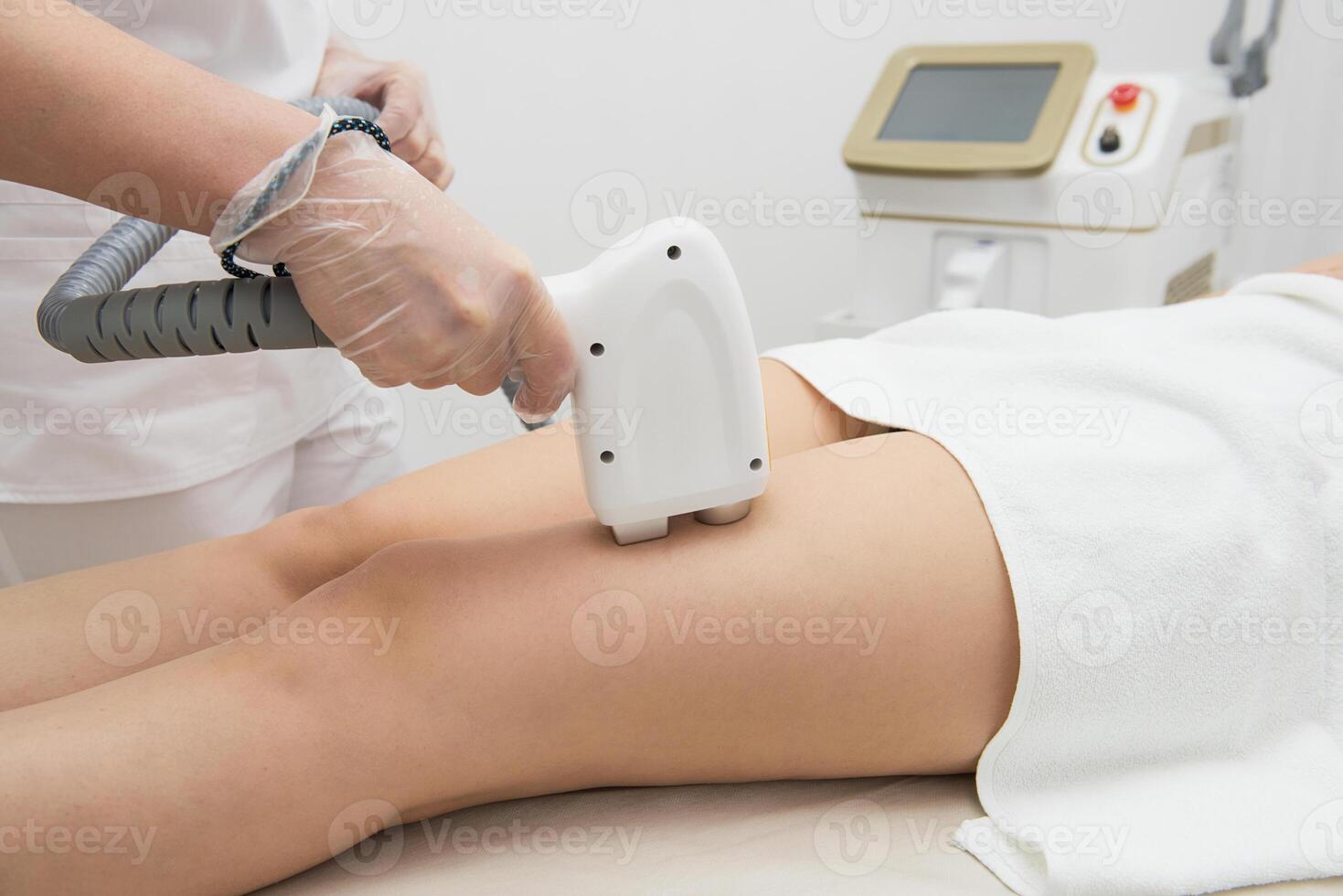 Laser epilation of legs photo