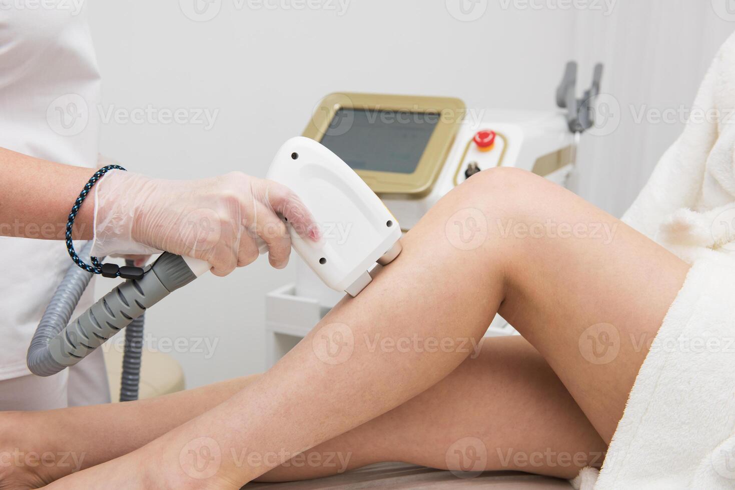 Laser epilation of legs photo
