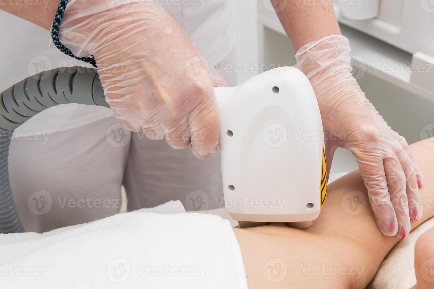 Laser epilation of armpits photo