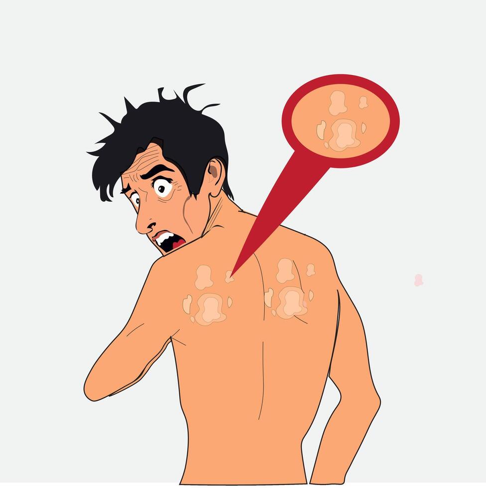 The man was shocked to see ringworm on his back, on his back. vector