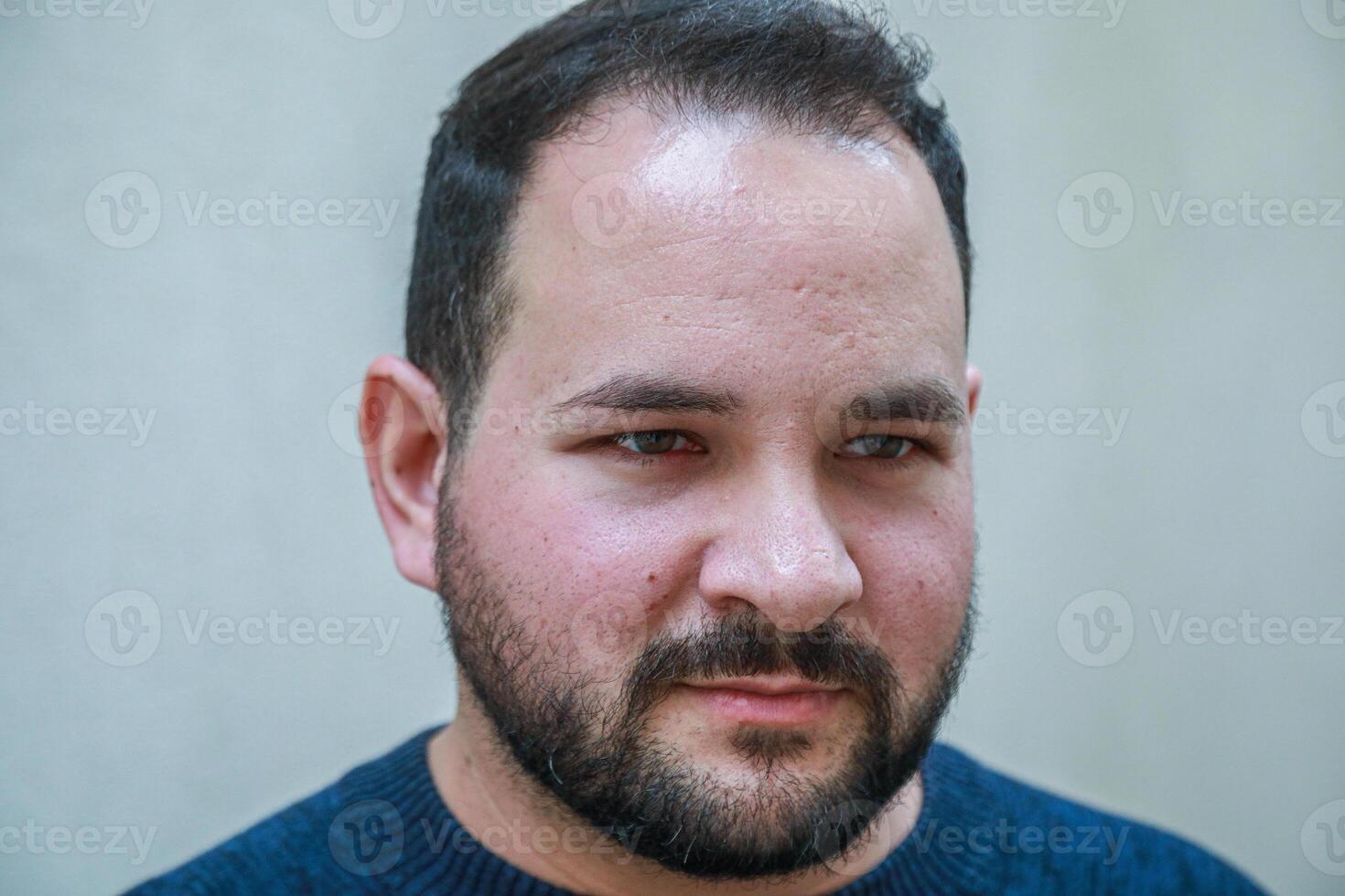 Man Is Mad And His Face Tell Everything photo