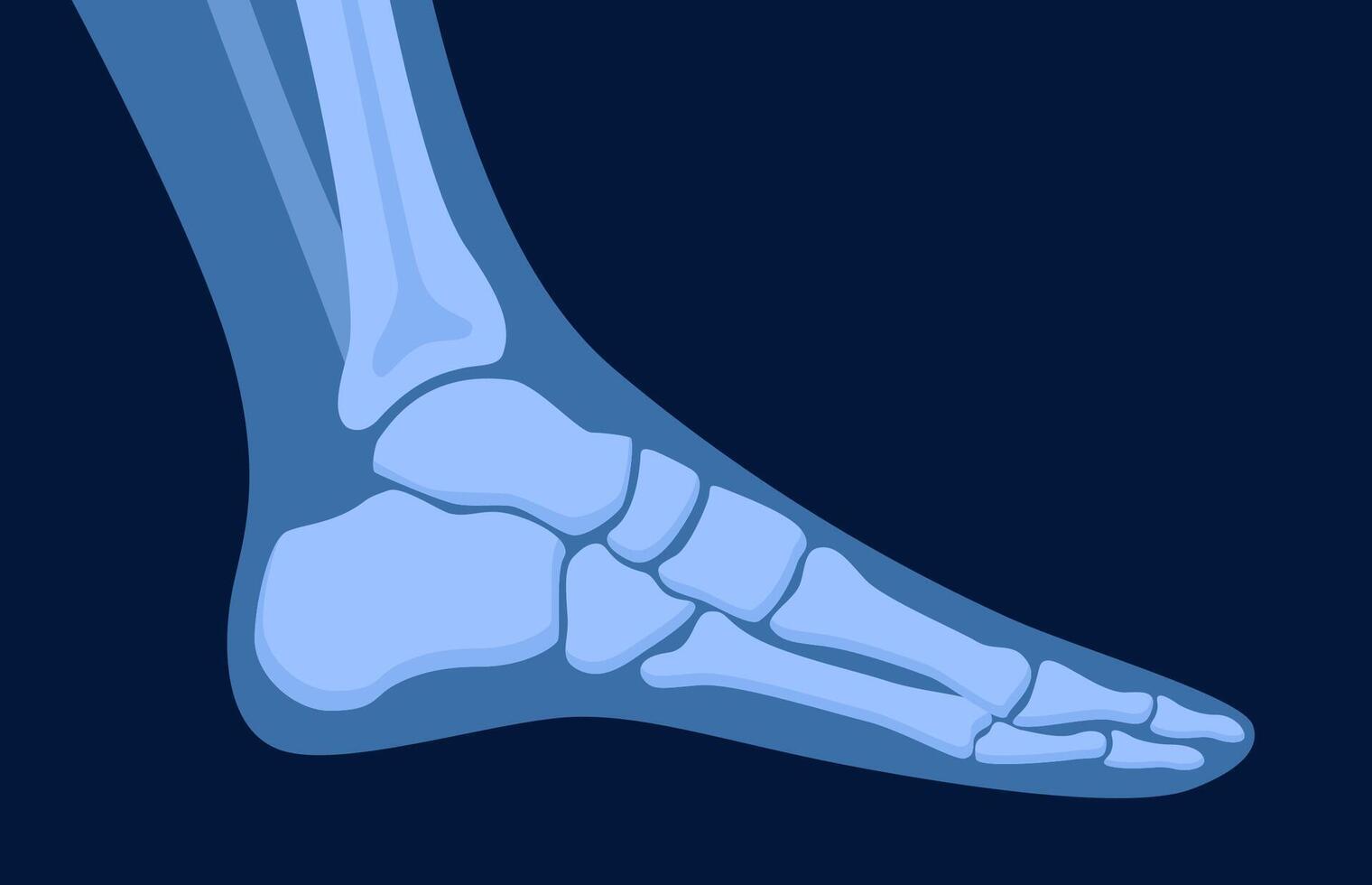 X ray human foot. X-ray picture or radiographic monitor image of metatarsus bones and toes. Medical radiology. illustration. vector