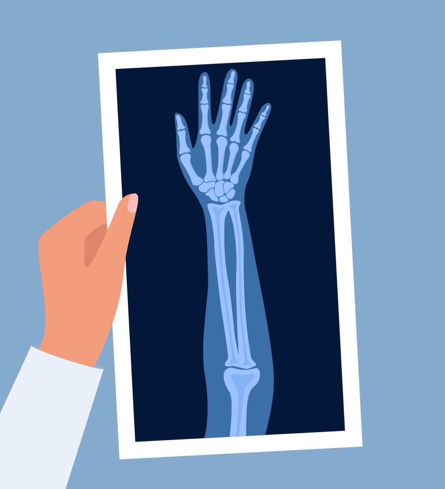 X ray human hand. Body bone roentgen front view. Medical anatomy. Arm checking healthcare joint palm finger exam. Roentgen shot in doctors hand. illustration. vector