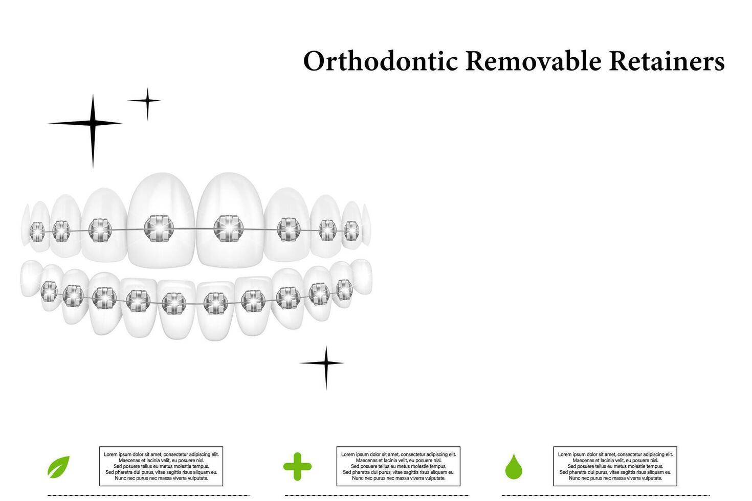 3D realistic composition of dental implantation. Illustration for dentistry vector