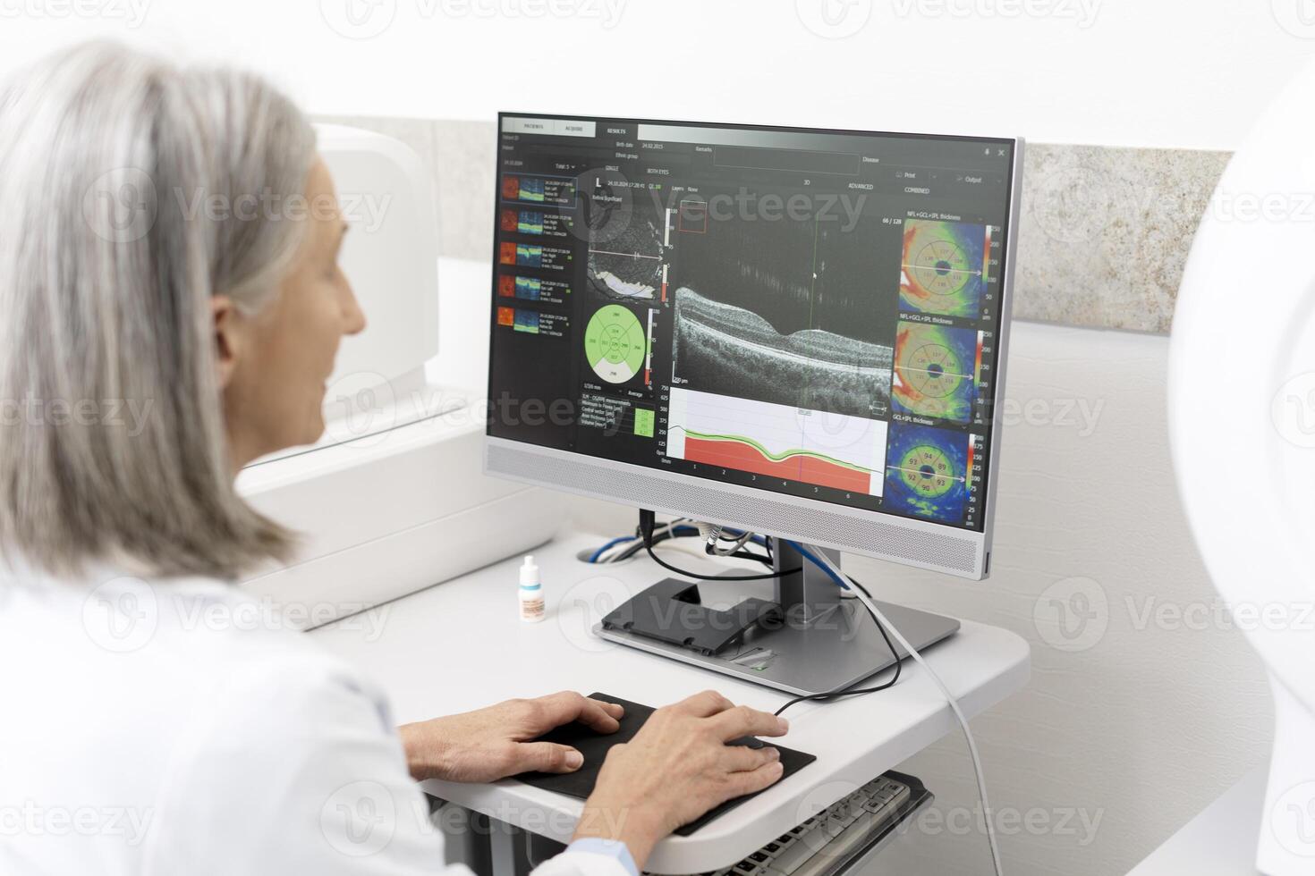 Senior doctor analyzing optical coherence tomography scan on computer in ophthalmology clinic photo