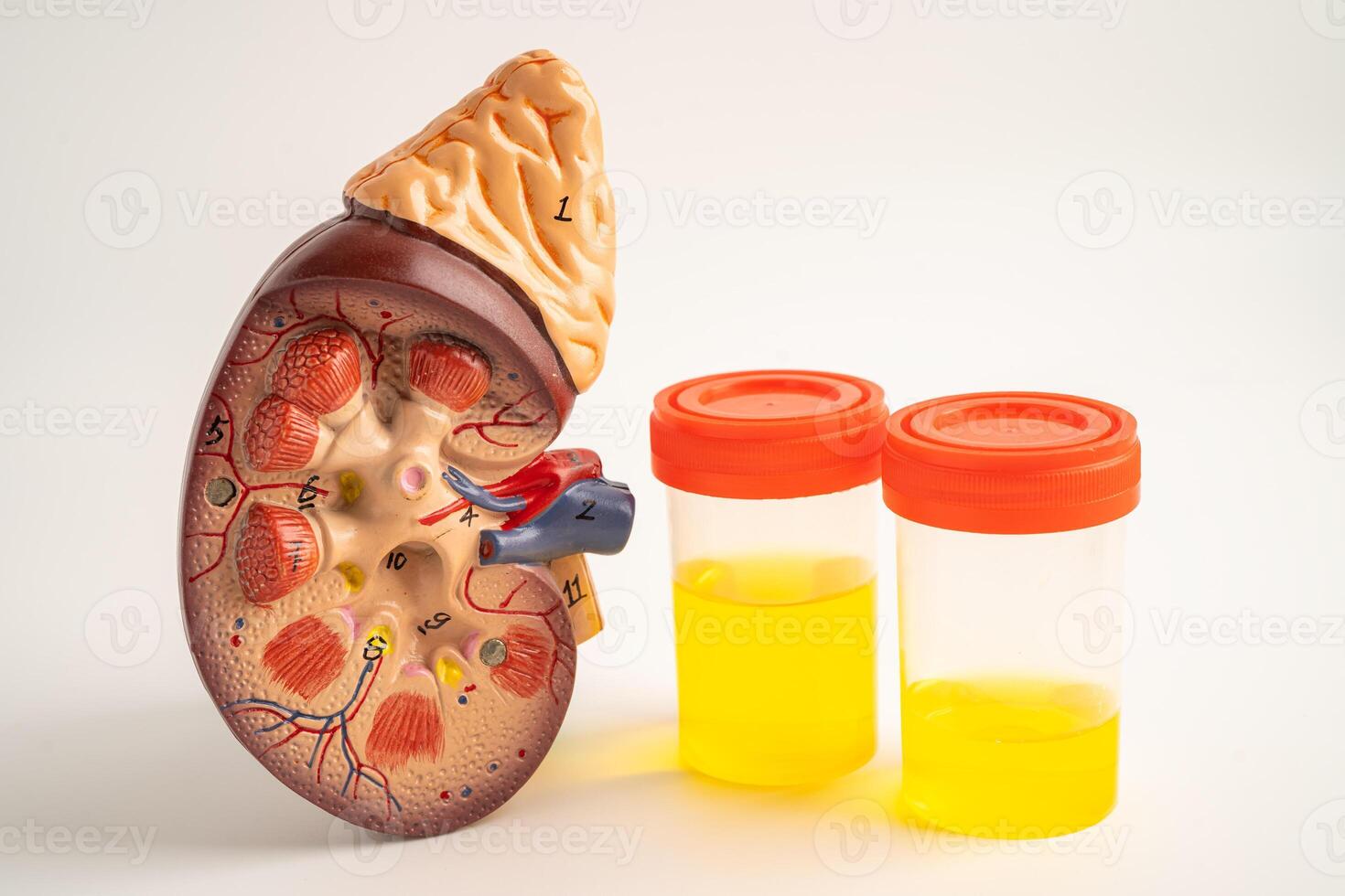 Urinalysis, Kidney model and urine cup with reagent strip pH paper test and comparison chart in laboratory. photo