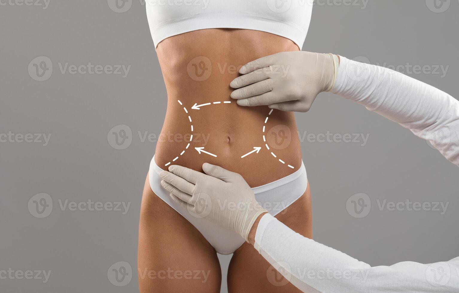 Body Contouring Concept. Unrecognizable Doctor Wearing Gloves Touching Female Body With Marked Lines In Abdomen Zone, Woman Patient Preparing For Liposuction Plastic Surgery, Cropped Shot photo