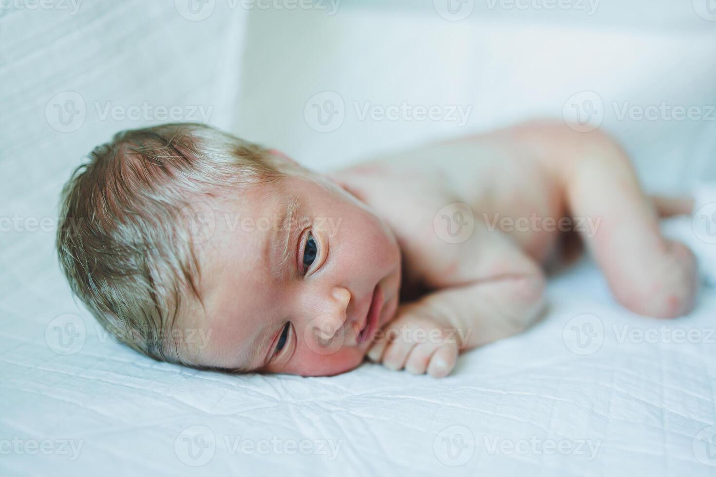 A newborn baby is lying on a diaper with a red rash on his body. Sweating of a newborn child. photo