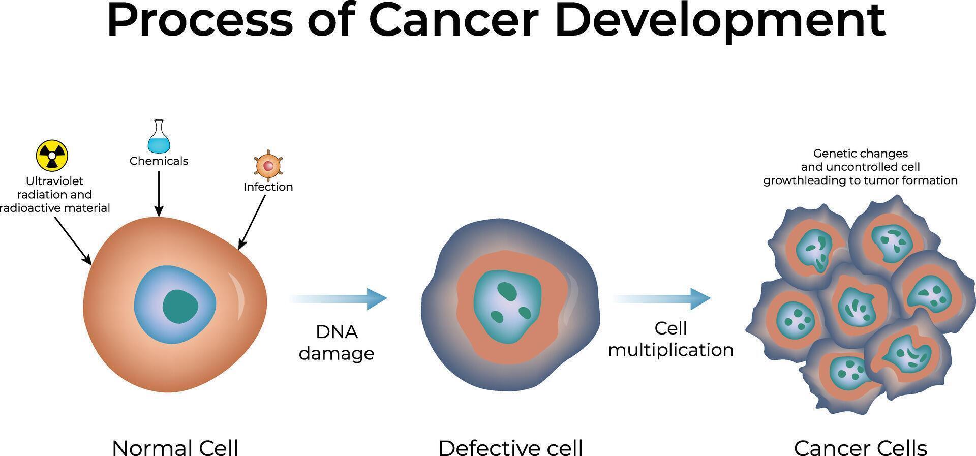 Process of Cancer Development Design Illustration vector