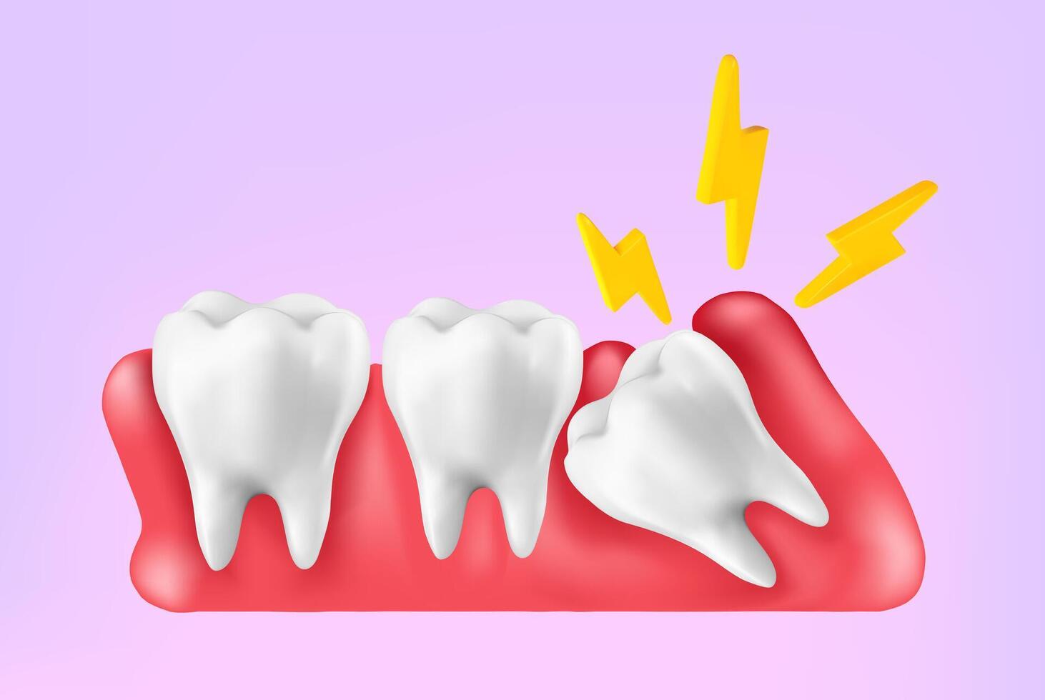 Illustration 3d realistic of wisdom tooth under gum cause of pain and lean on other teeth cause of tooth decay. Concept of pain in mouth, toothache, Mesh gradient wes used vector
