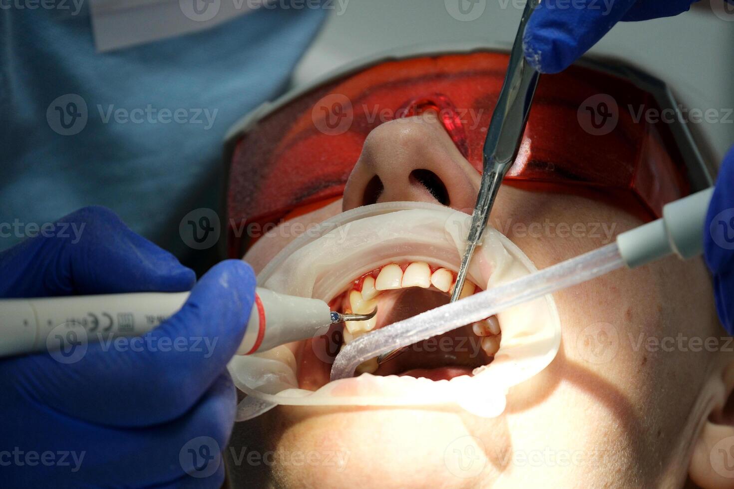 Close-up cropped shot of young woman at the dentist's chair during a dental procedure looking up and smiling. Dentist examining patient's teeth in modern clinic. Healthy teeth and medicine concept. photo