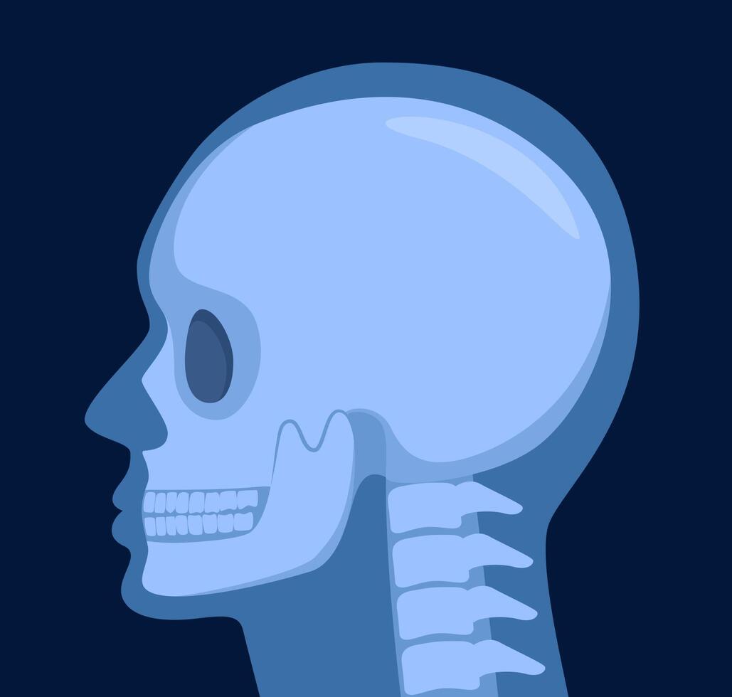 X-ray shot of skull, human body, head and neck bones side view, radiography, vector