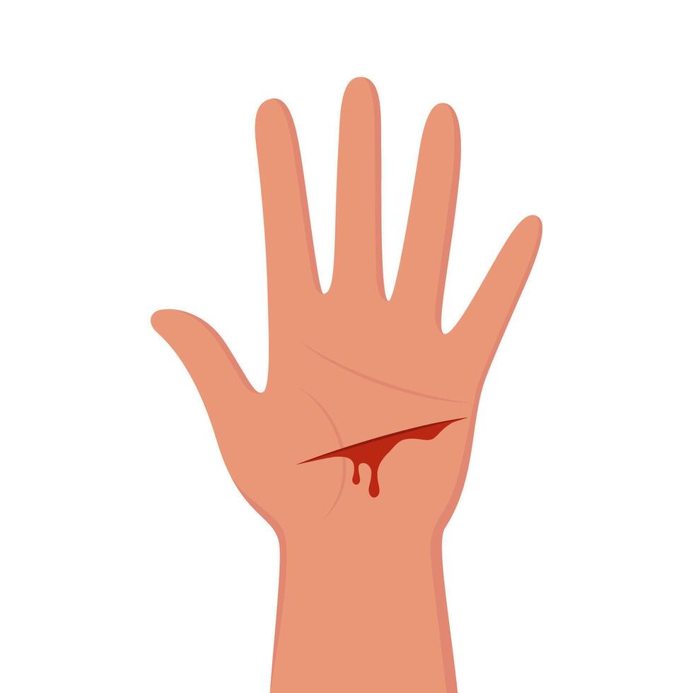 Bleeding cut on the palm, emergency situation. First aid treatment for wound on skin. Trauma, treatment procedure. illustration. vector
