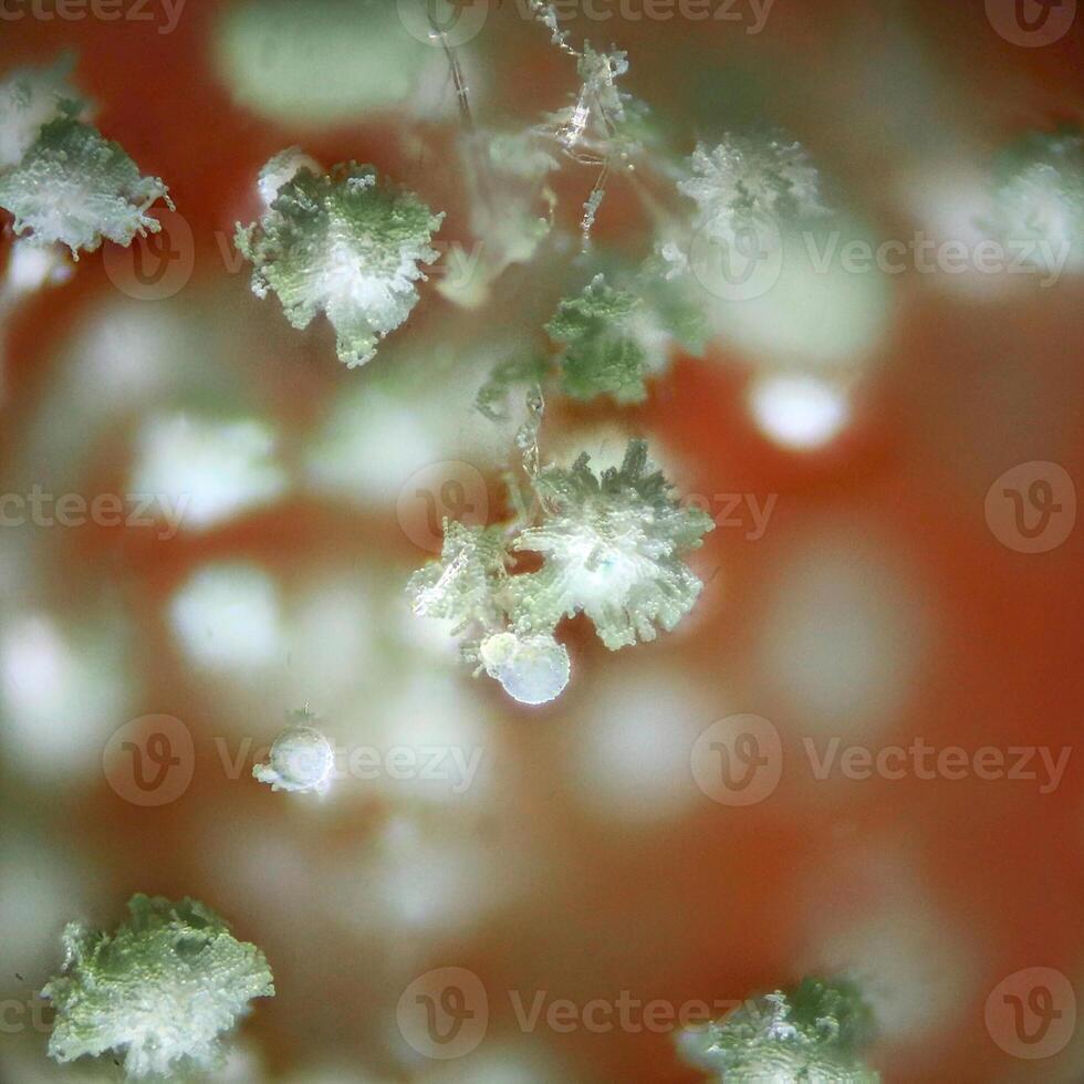 Aspergillus spore heads in reflected light microscopy, showing intricate fungal growth and blurred background photo