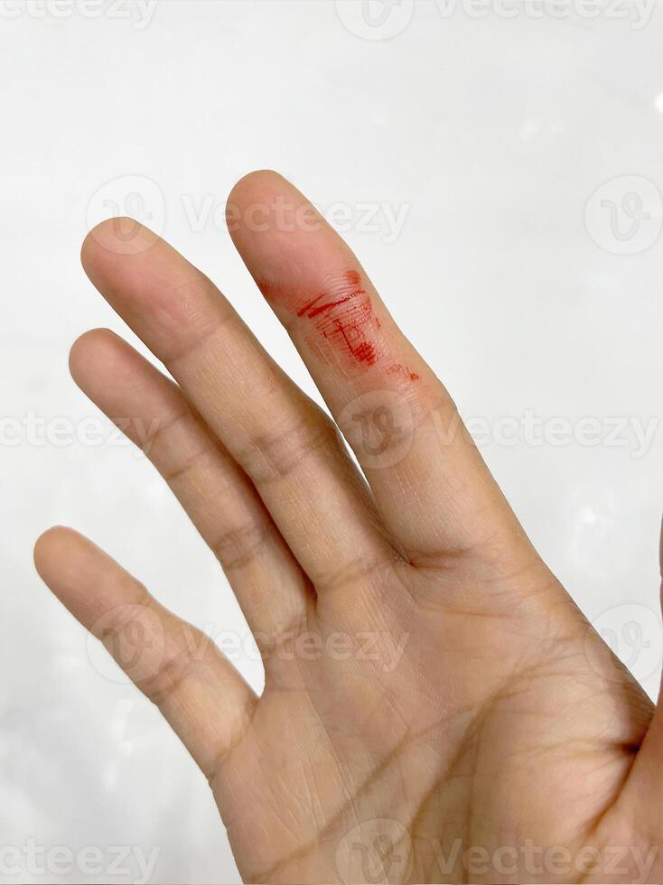 Finger with blood drop. Injured by sharp knife. photo