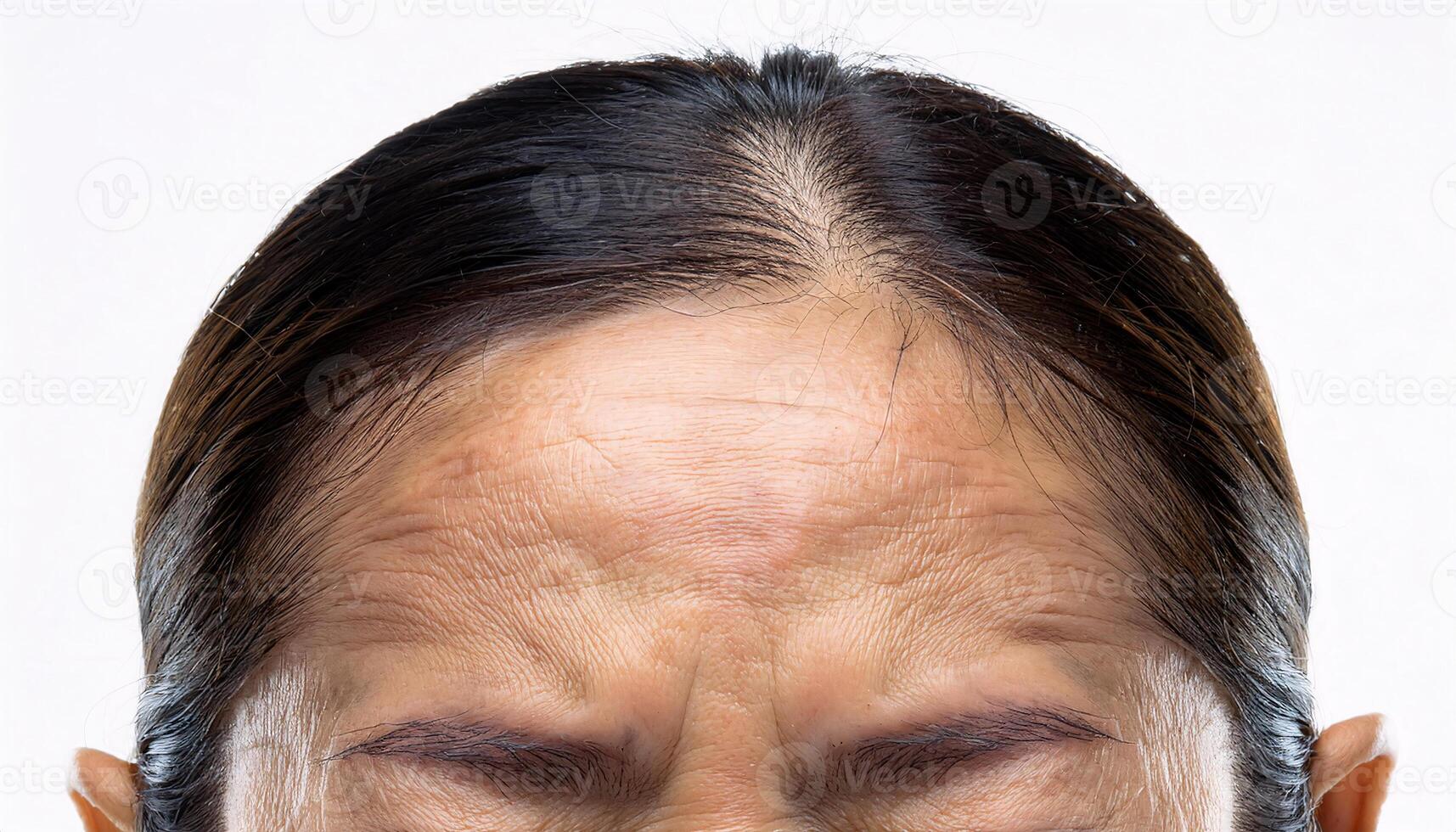 Detailed view of forehead lines from decades of aging, with pronounced texture in isolated white background photo