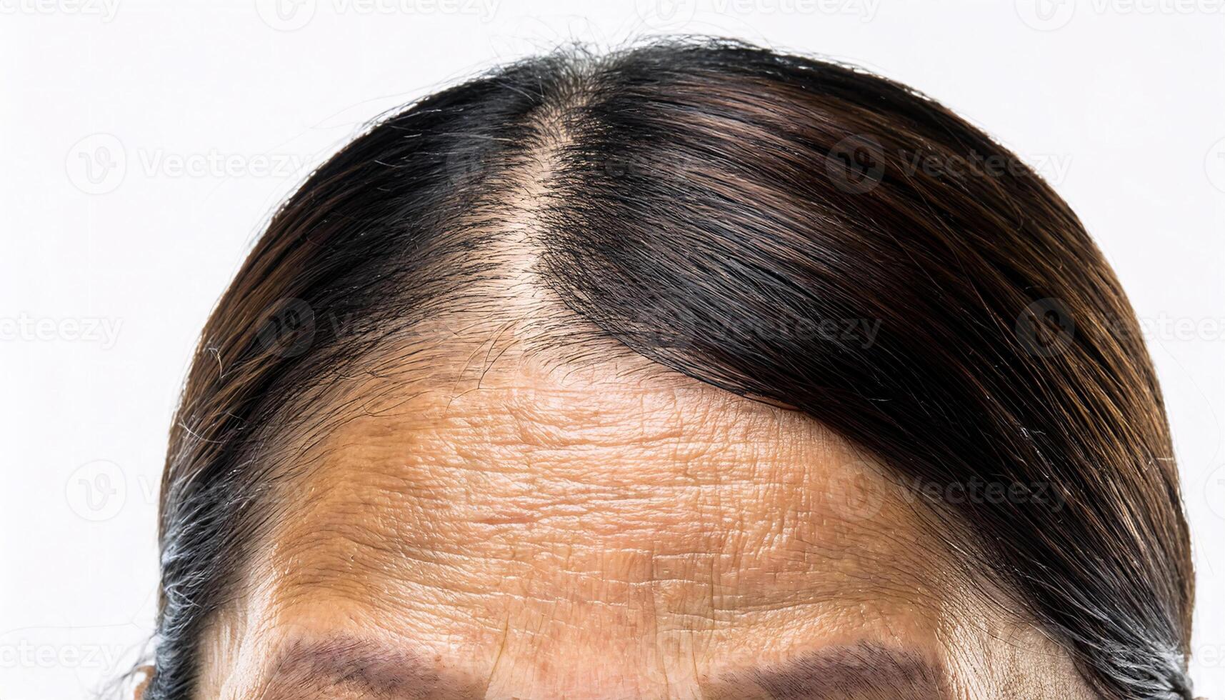 close-up of deep forehead wrinkles with visible skin texture and aging lines on mature skin in isolated white background photo