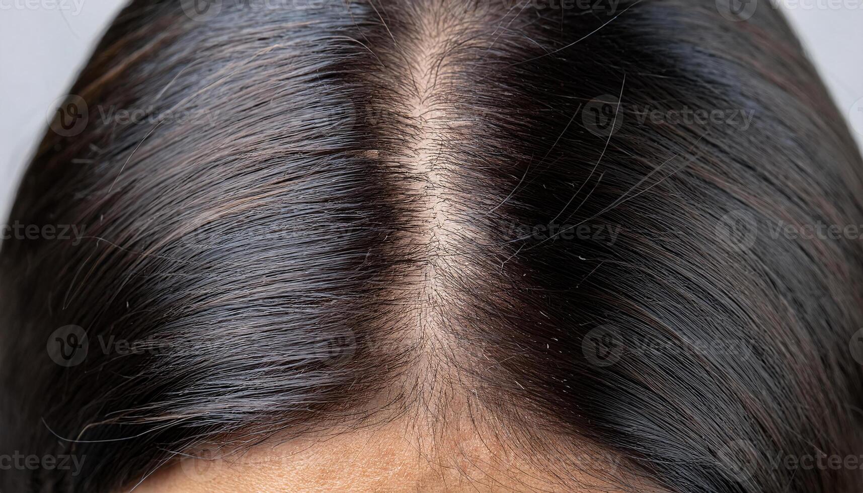 close-up of a scalp showing early signs of dandruff with parted shiny black hair and visible flaky skin for haircare and dermatological concepts photo