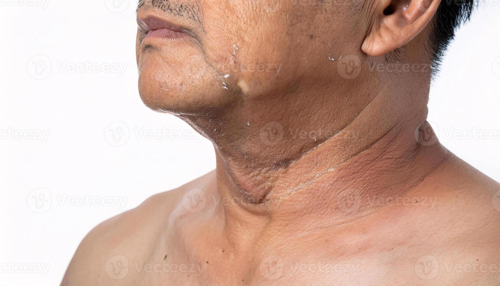 close-up of sagging skin under the chin with visible folds, wrinkles, and uneven texture in isolated white background photo
