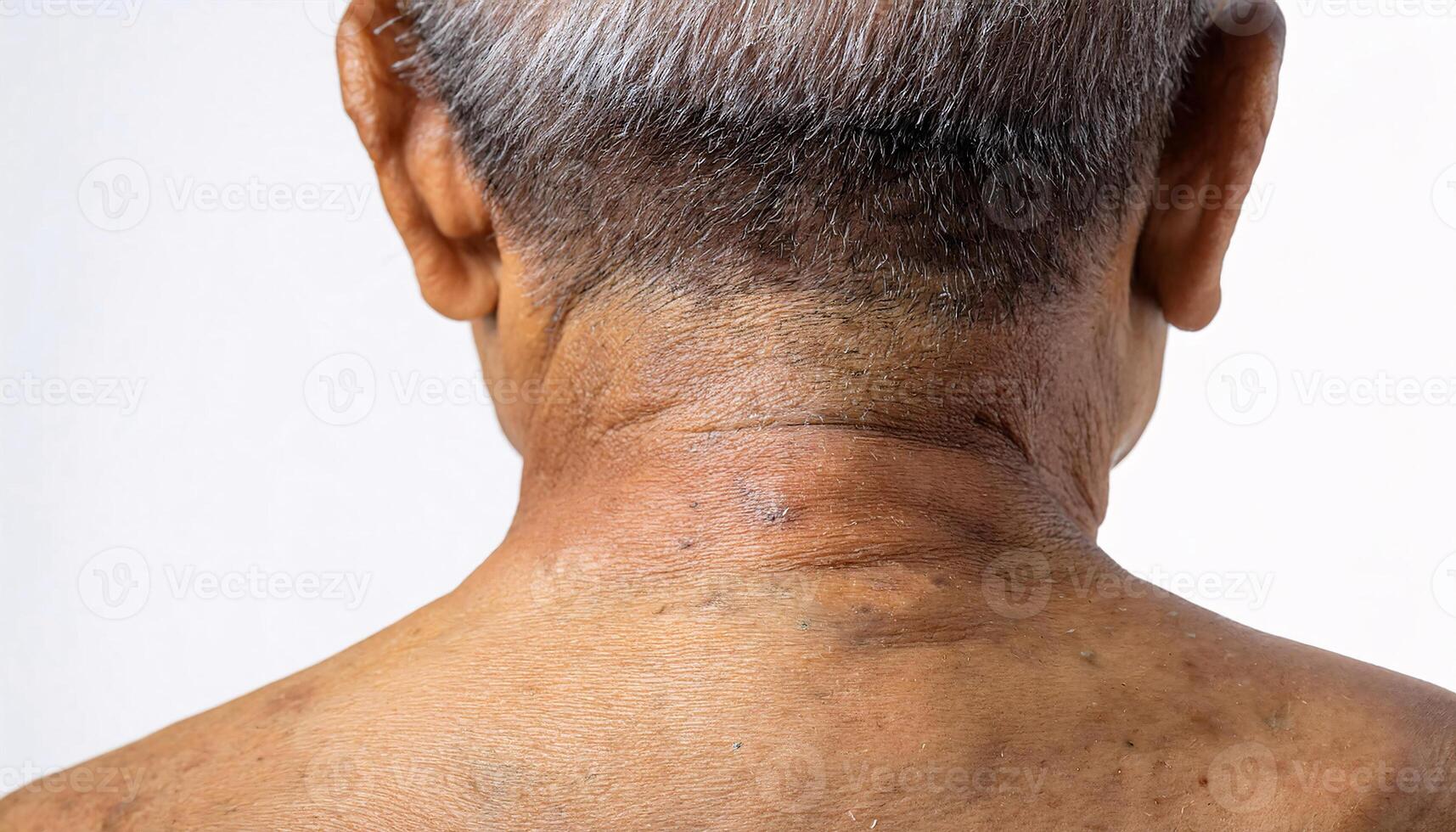 close-up of aged neck with visible folds, wrinkles, and rough skin texture highlighting signs of aging on isolated white background photo