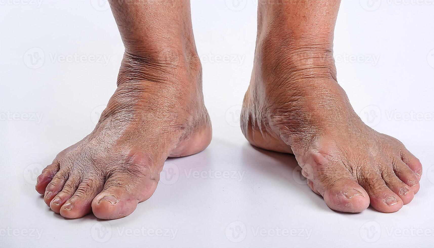 close-up of aged feet and ankles showing prominent veins, wrinkles, and dry skin texture on isolated white background photo