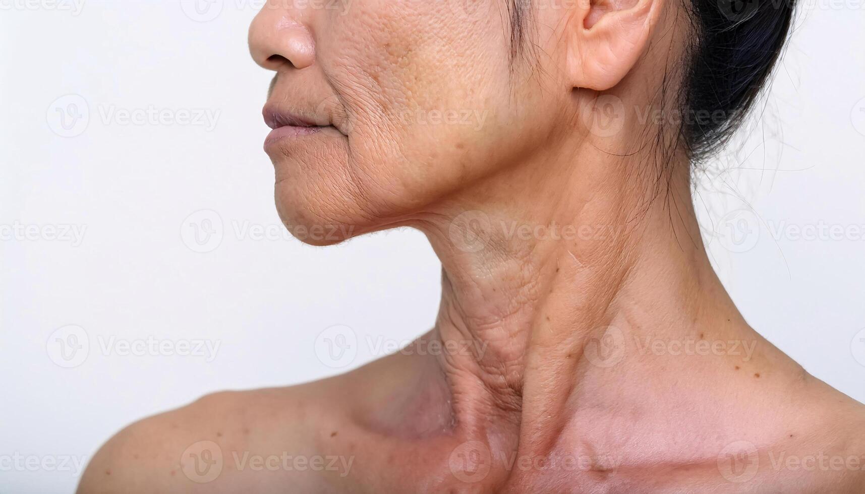 close-up of neck with sagging folds, discoloration, and faint wrinkles showing signs of aging in isolated white background photo