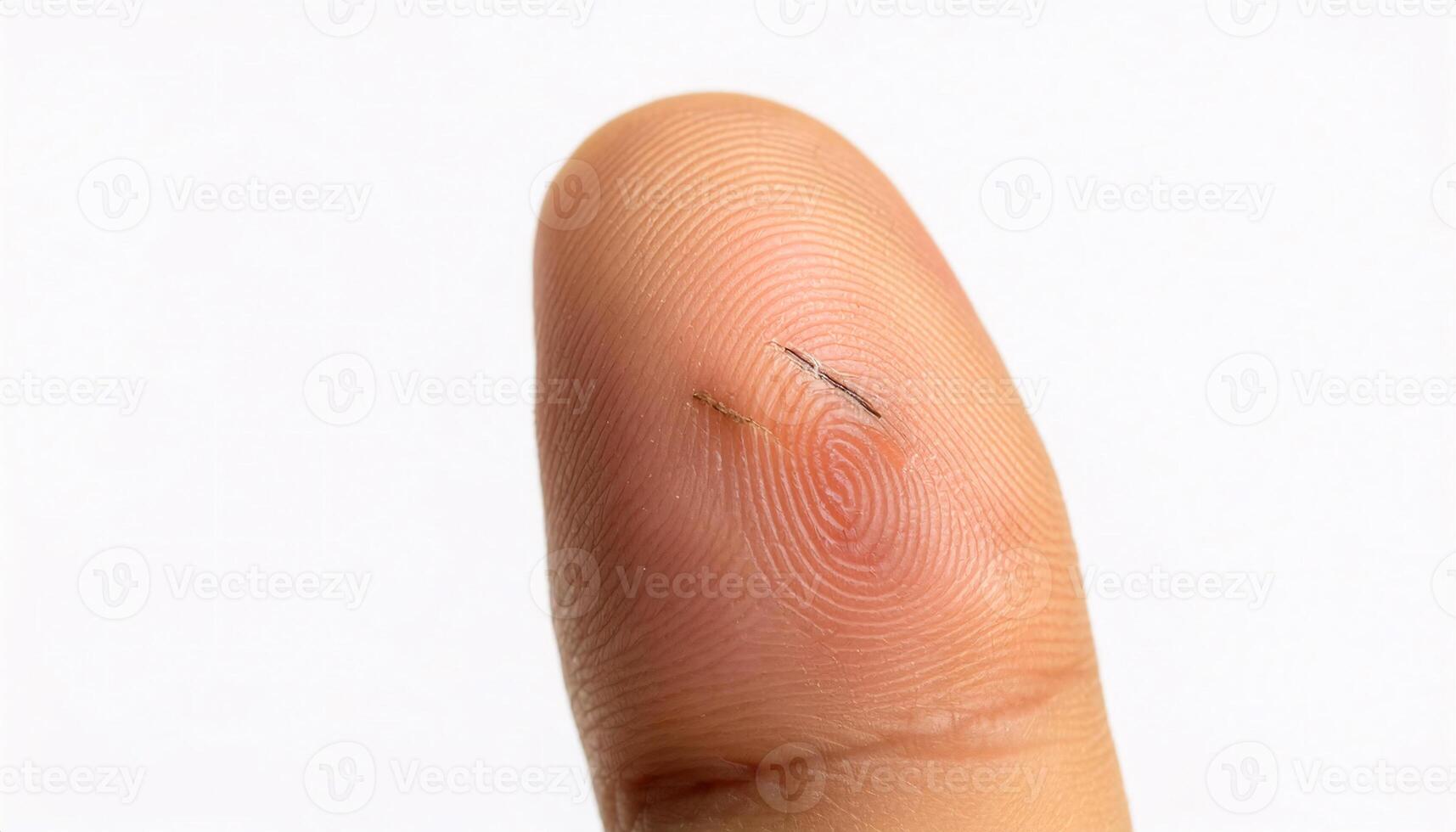 detailed close-up of a small scar on a finger caused by a sharp knife during cooking, showcasing delicate skin texture and healing process in isolated white background photo