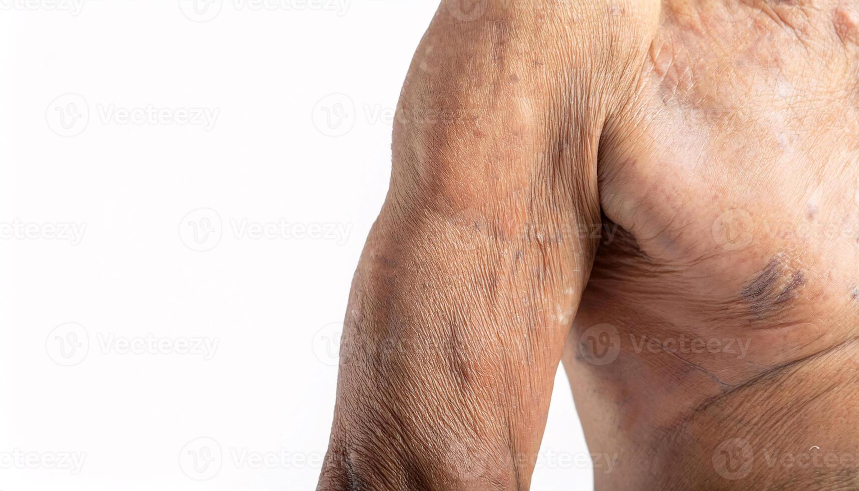 close-up of aged arm with visible wrinkles, sagging skin, and uneven texture highlighting signs of aging on isolated white background photo