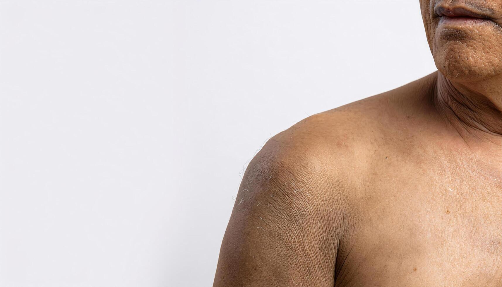 close-up of aged shoulder with visible drooping skin, folds, and fine creases showing signs of aging on isolated white background photo