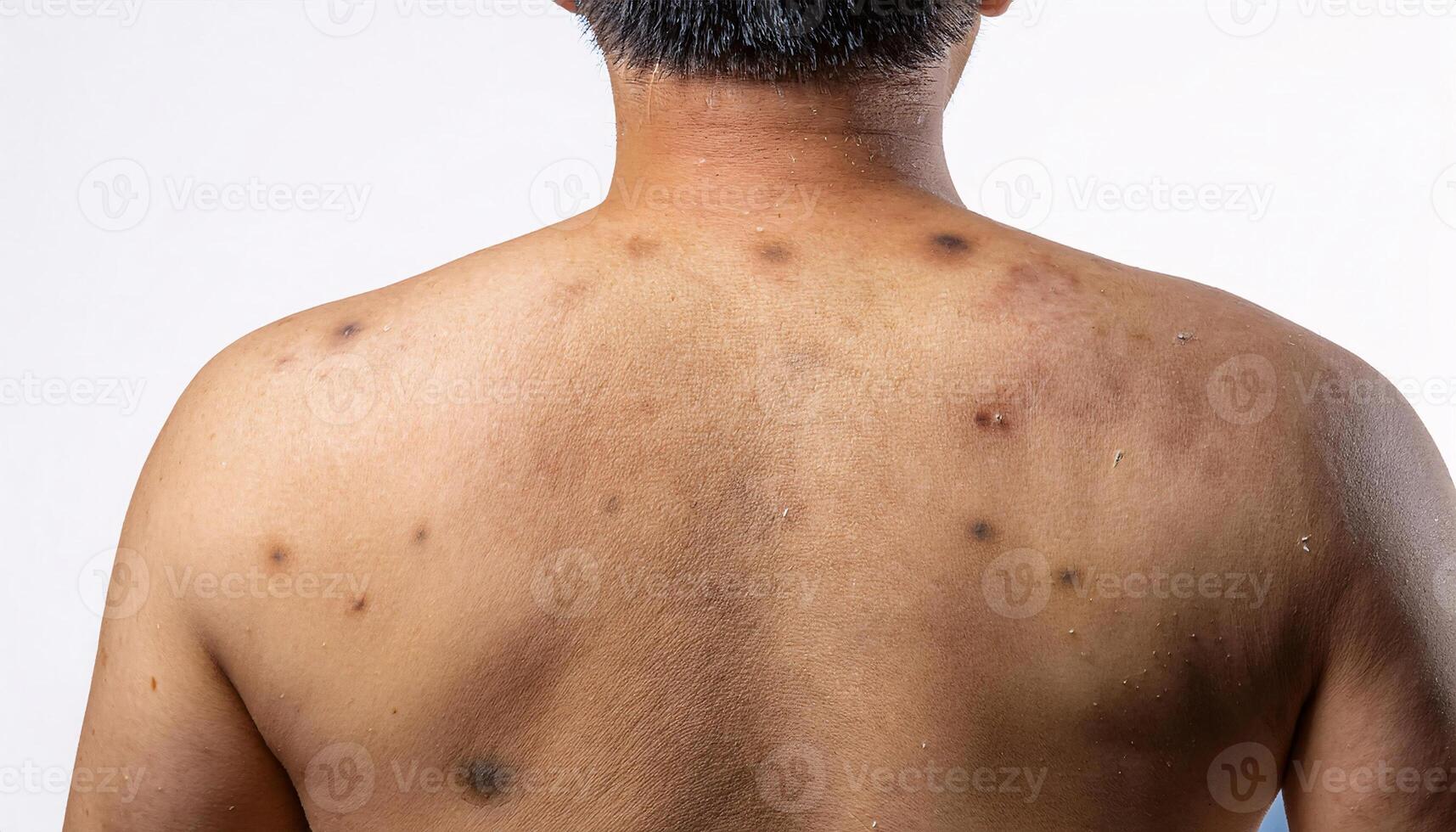 macro view of liver spots and uneven skin texture on the back, showcasing signs of aging in isolated white background photo
