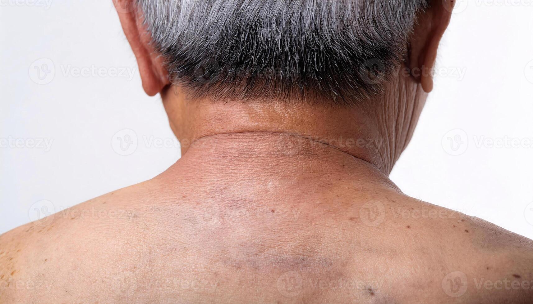 close-up of aged neck with deep folds, wrinkles, and uneven skin texture showing signs of aging on isolated white background photo