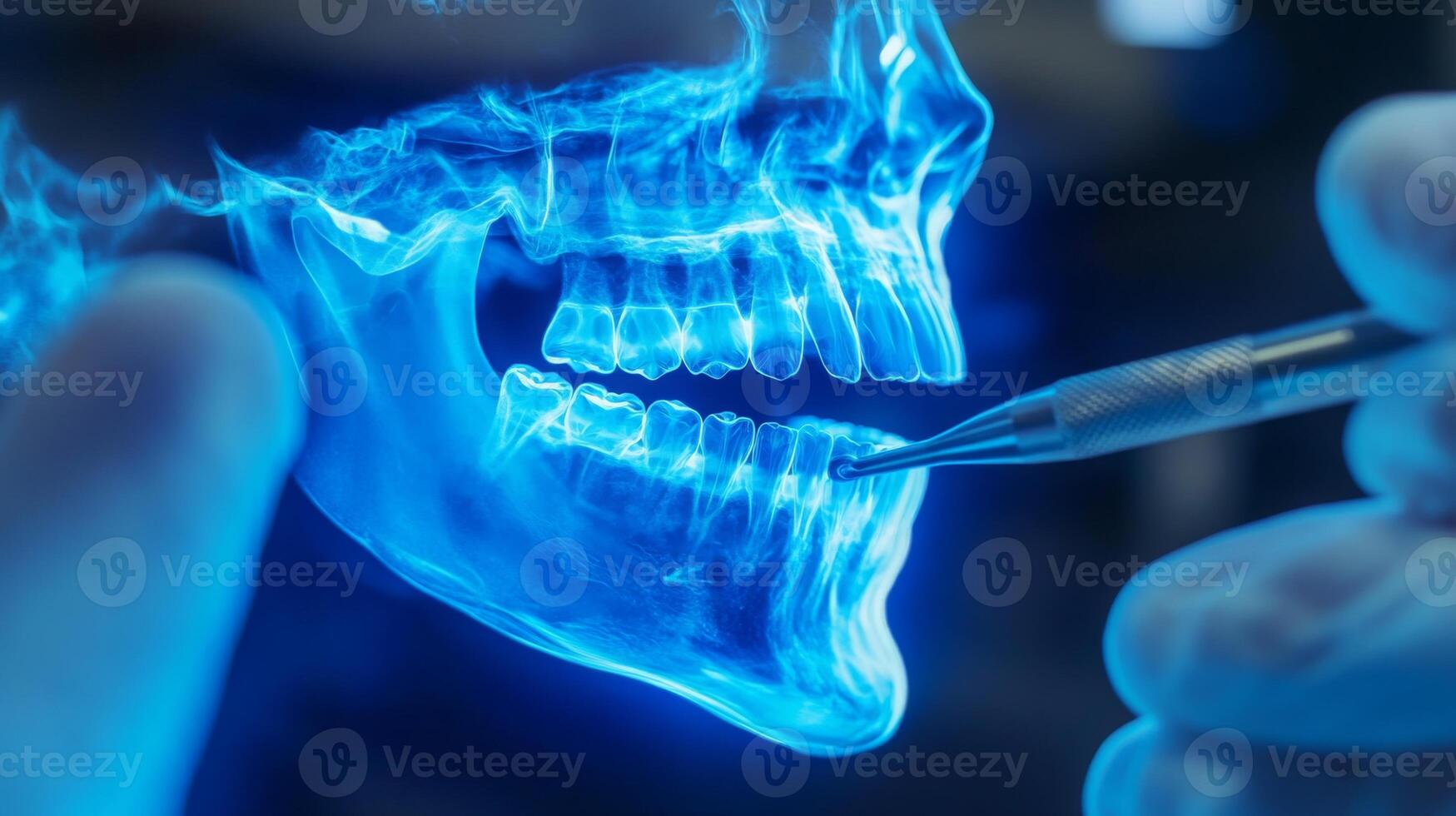 A medical professional analyzes a clear x-ray image of a human skull, focusing on the teeth and jaw structure. The use of enhanced imaging aids in diagnosing dental issues effectively. photo