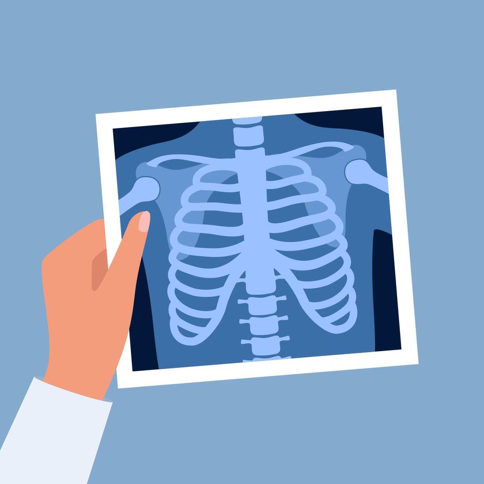 X ray of human skeleton chest and pelvis human bones. Roentgen shot in doctors hand. Medical analyzing. Anatomical bone medicine laboratory radial scan. . vector
