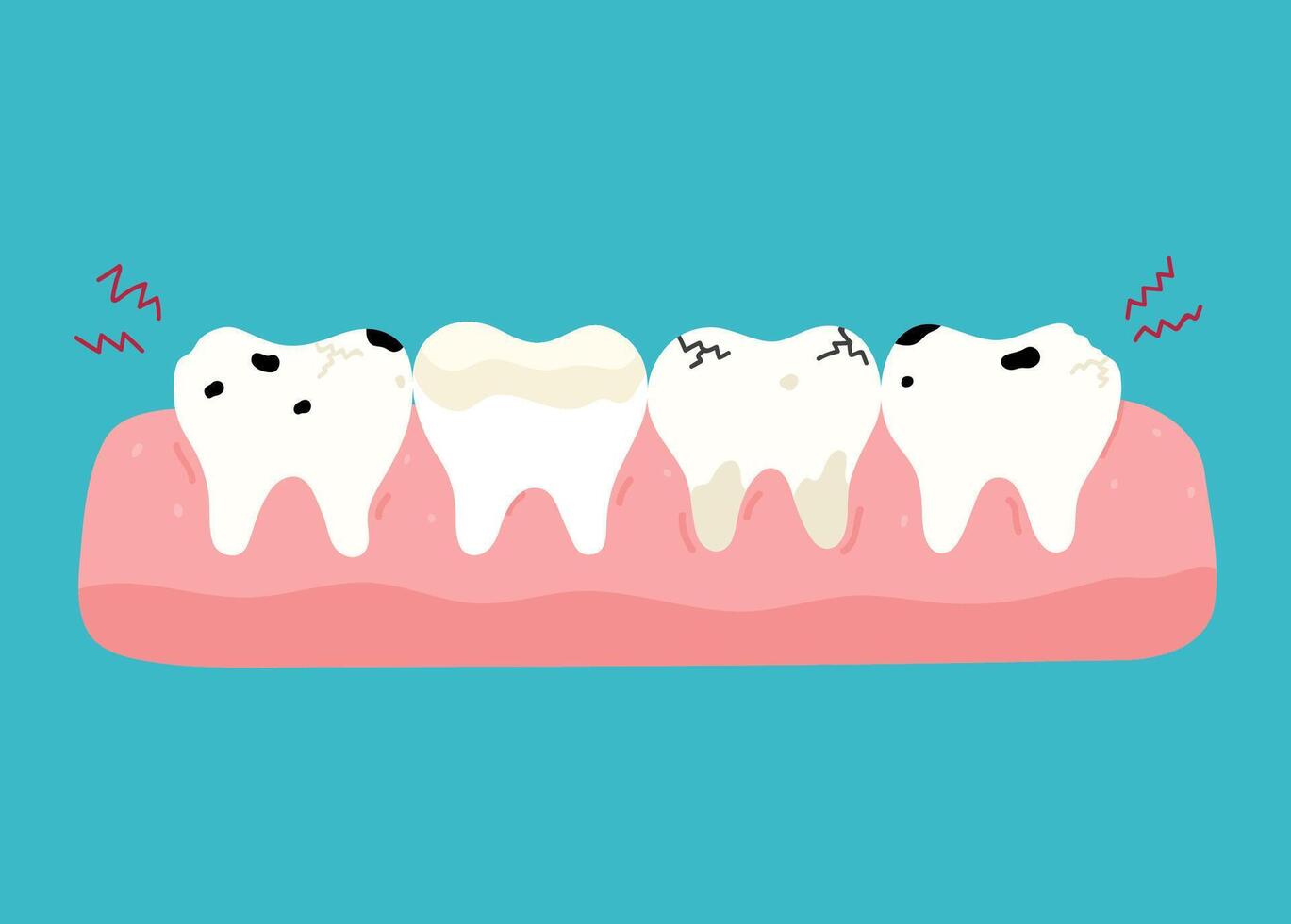 Diseased teeth with caries, cracks, chips, inflammation, plaque. Toothache. hand-drawn illustration in flat style. Dental care, oral hygiene concept. vector
