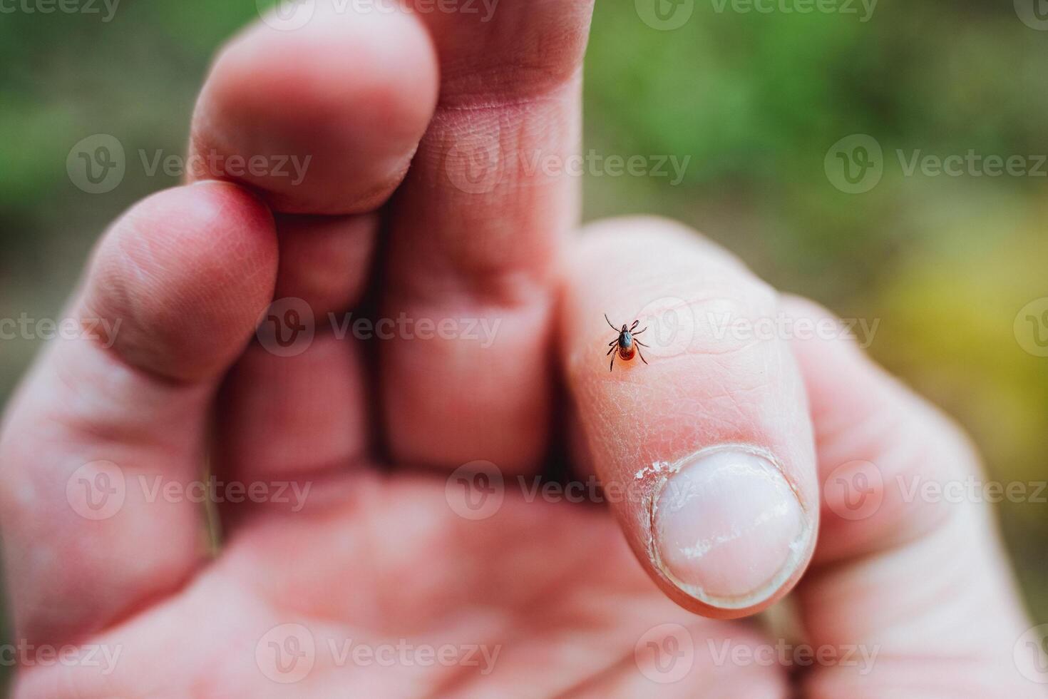 A tick crawls on a man's finger, a dangerous little insect, a red tick ass. photo