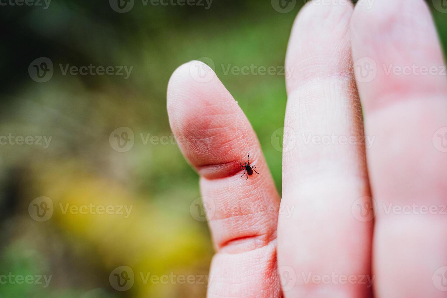 A small tick crawls on a person's hand, a dangerous insect, a carrier of the disease encephalitis, a tick has bitten into a finger. photo