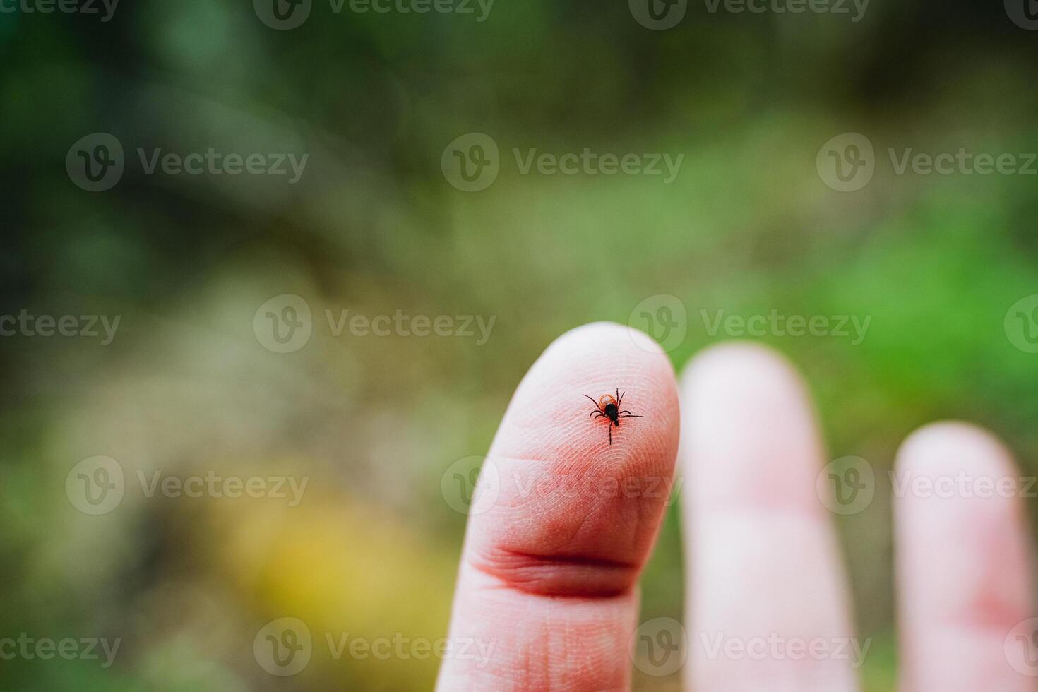 Closeup of a persons finger showing a tick attached photo