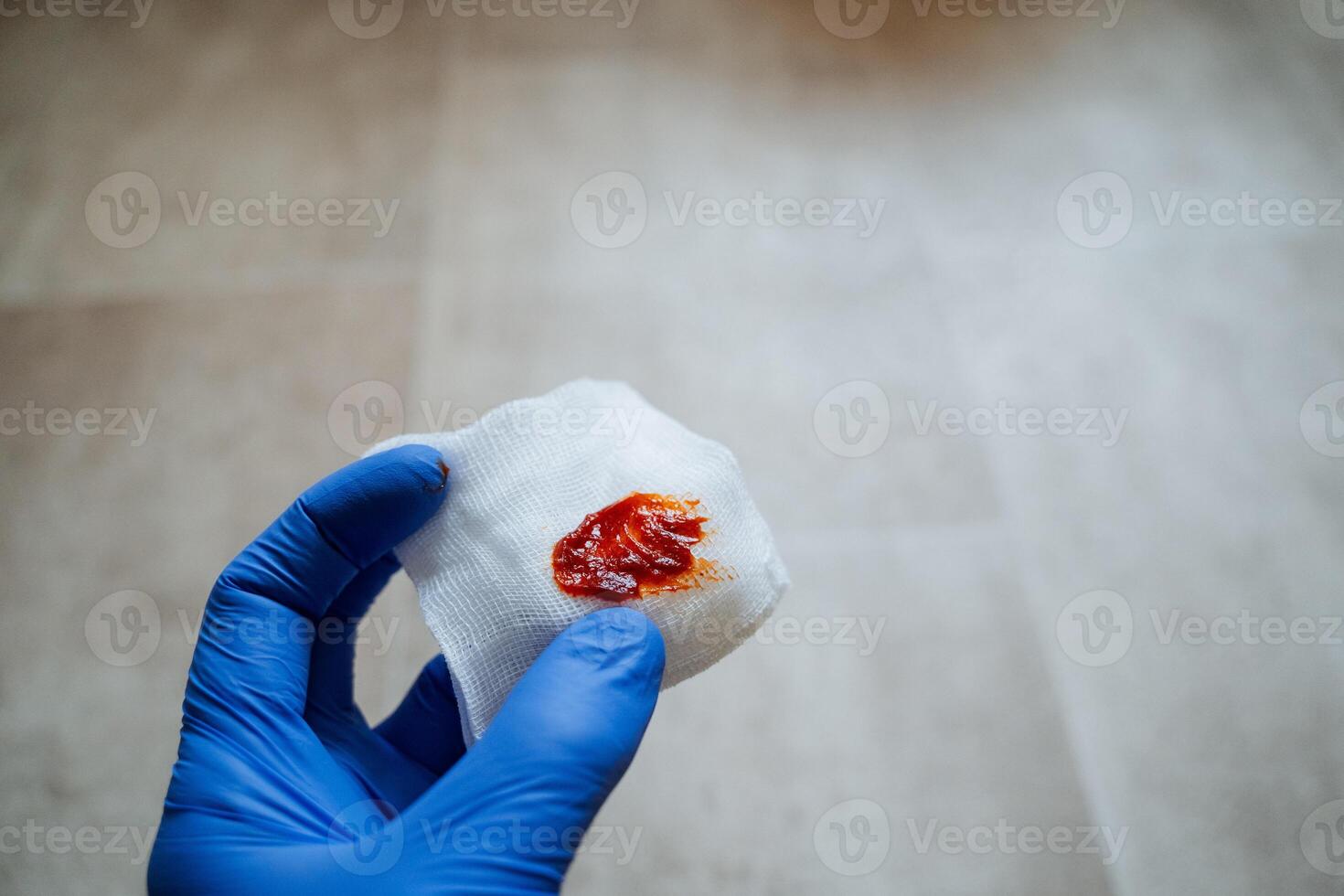 A medical professional is carefully holding a swab containing a blood sample for thorough analysis in a clinical laboratory setting photo